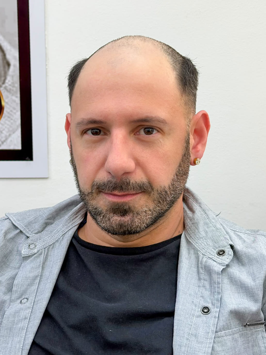 Pablo Castro de frente: pelo al ras, entradas marcadas y la parte de arriba de la cabeza calva.